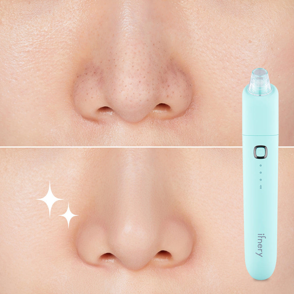 Ifnery Clear Pore Device